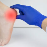 Achilles Tendonitis Recovery Time: How Long Does It Take?